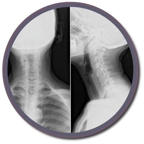 Gonstead X-rays